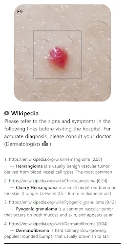 Model Dermatol: Atlas de Enfermedades de la Piel – Descarga Gratis - Screenshot 5