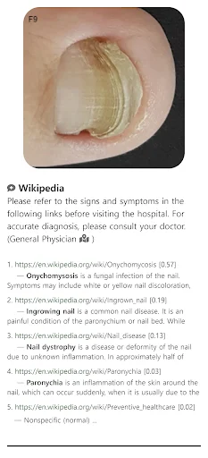 Model Dermatol: Atlas de Enfermedades de la Piel – Descarga Gratis - Screenshot 1