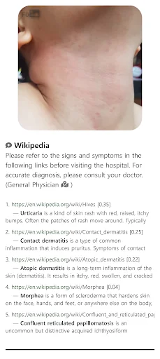 Model Dermatol: Atlas de Enfermedades de la Piel – Descarga Gratis - Screenshot 6